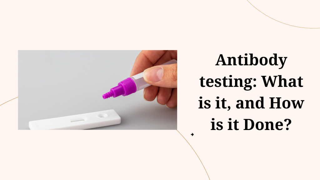 Antibody testing: What is it, and how is it done?
